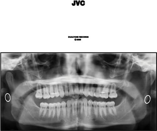 JVC (New LP)